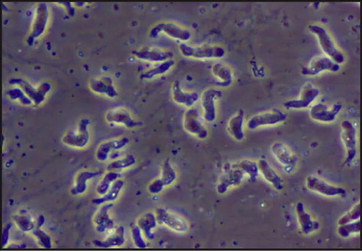 Fatal bacteria found in Texas water supply Fatal bacteria found in Texas water supply