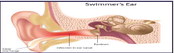 Prevent swimmer’s ear, disinfect pools Prevent swimmer’s ear, disinfect pools